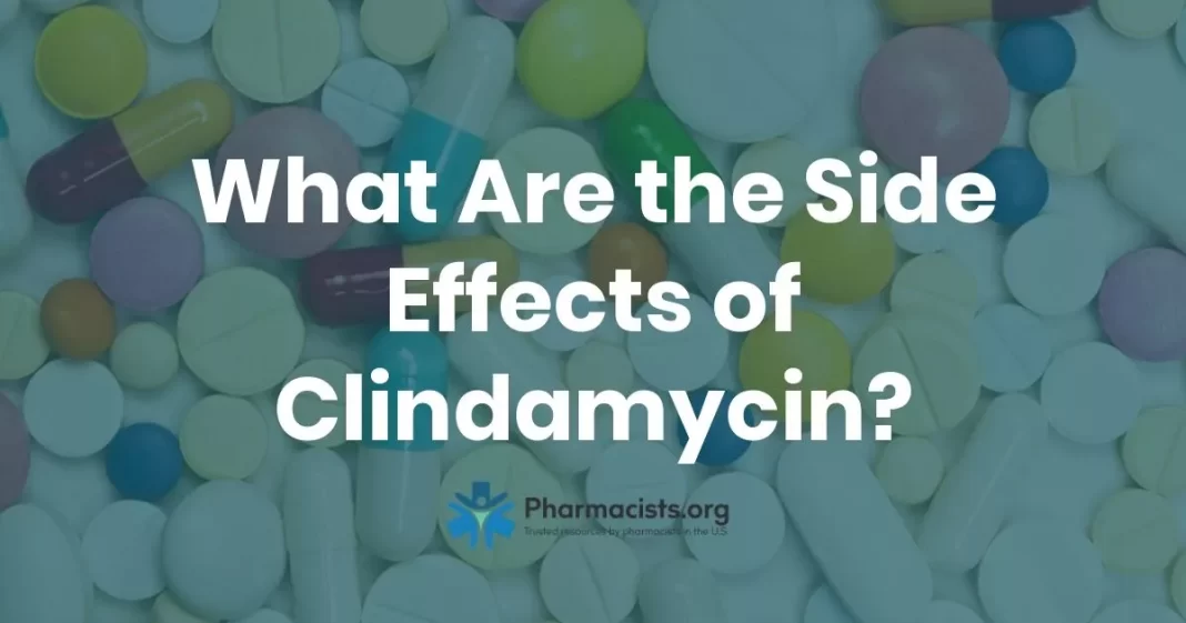 Clindamycin Tablet Benefits and Side Effects
